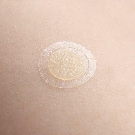 [Medical Device] DUODERM Spot Patch 72 Counts