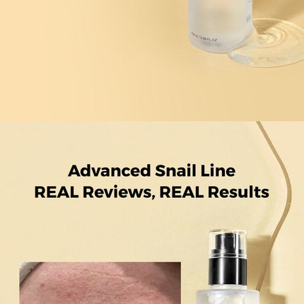 COSRX Advanced Snail 96 Mucin Power Essence 100 mL