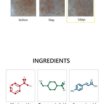 CURESYS Dark Spot AC Patch