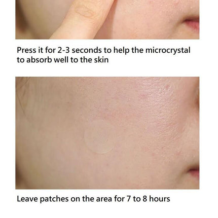 CURESYS Dark Spot AC Patch