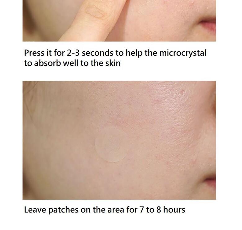 Ac Patch CURESYS Dark Spot AC Patch – Keautiful